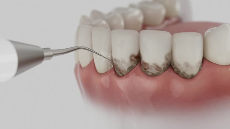 Trusted Dental Crowns And Bridges service in Benton, KY - Dentist Open Now